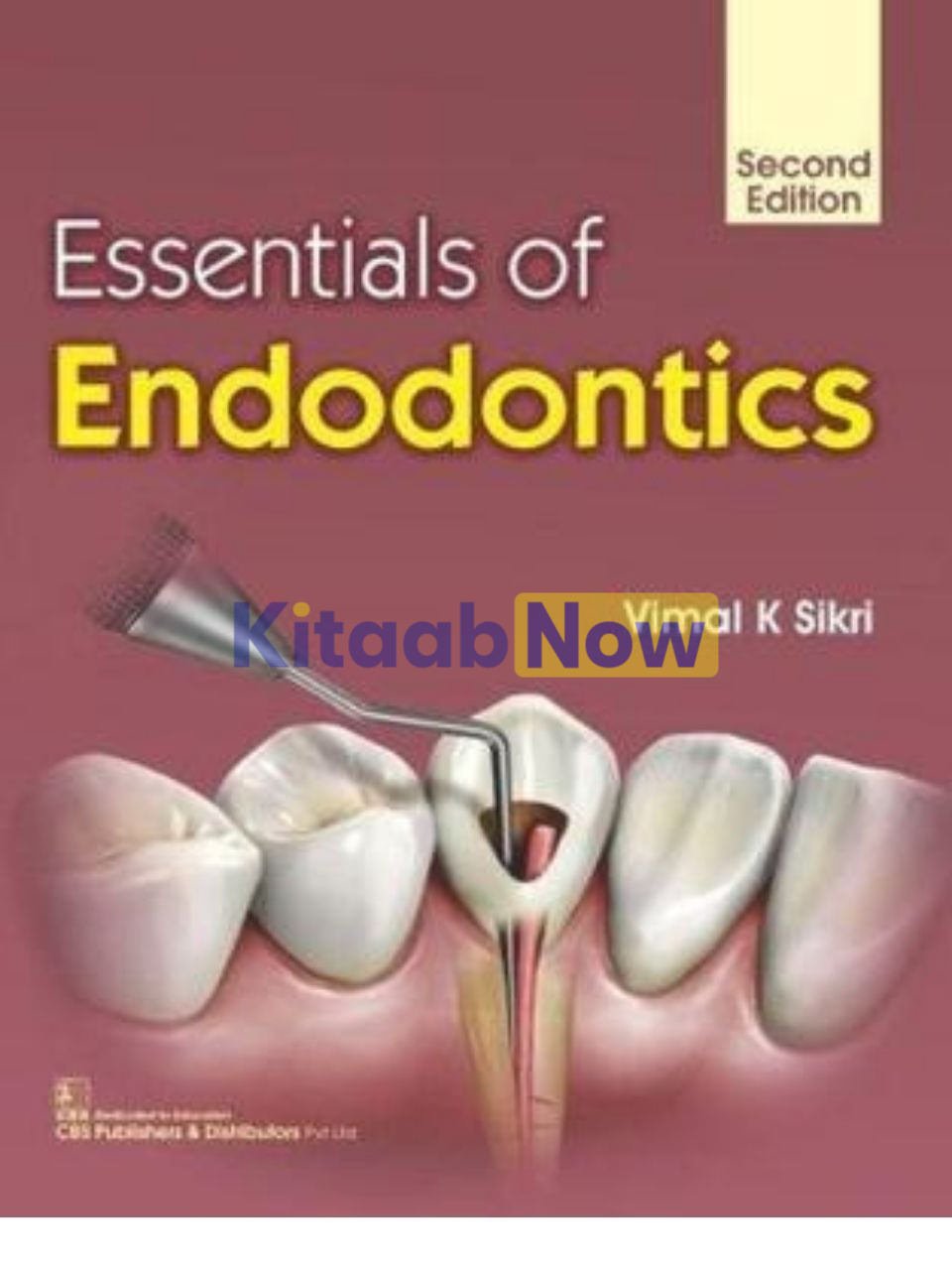 Essentials Of Endodontics