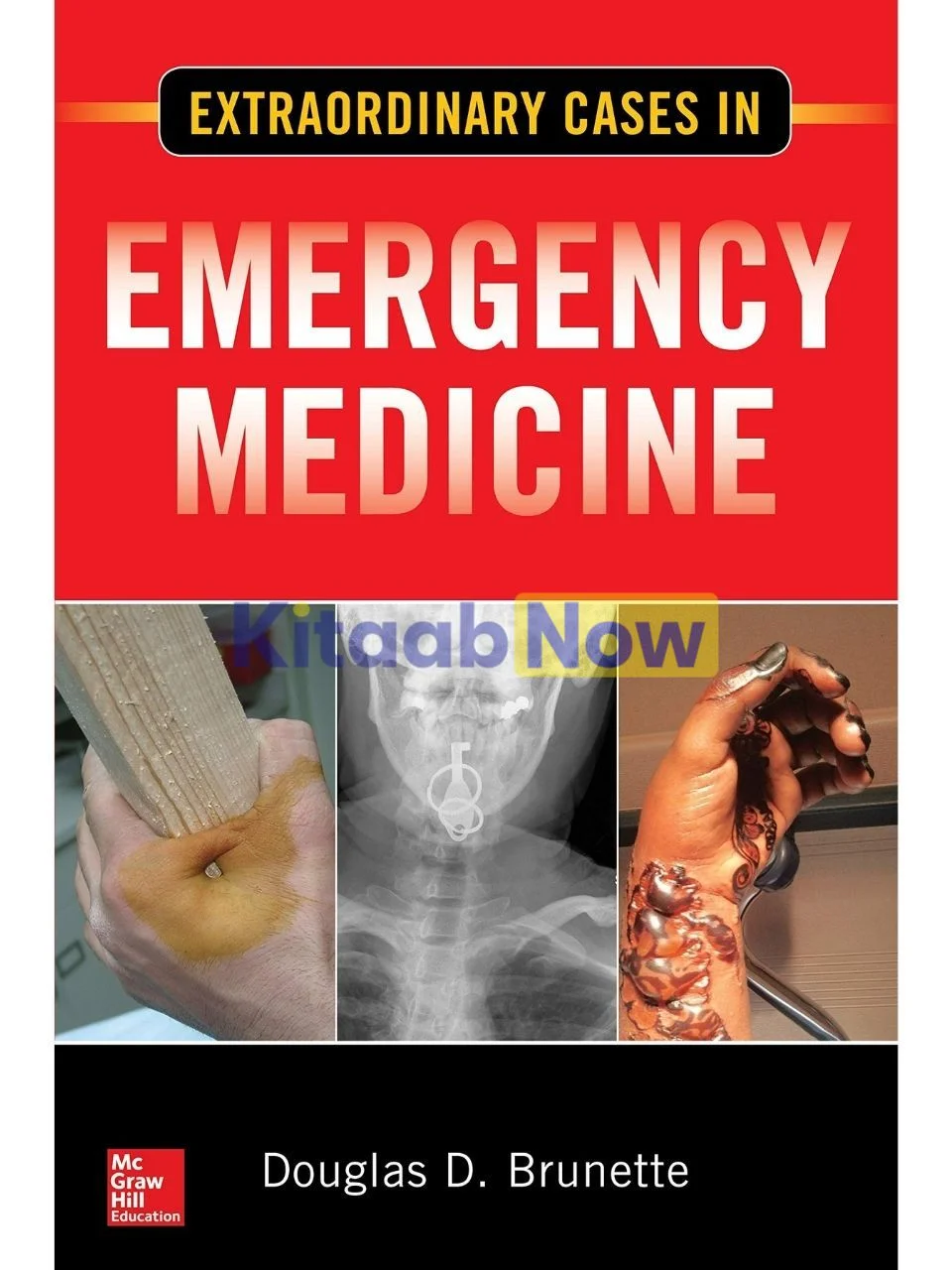 Fleisher & Ludwig's Textbook of Pediatric Emergency Medicine (8th