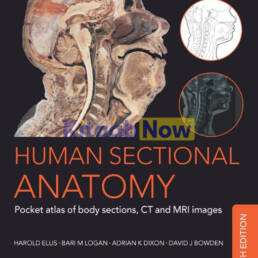 Human Sectional Anatomy: Pocket Atlas of Body Sections, CT and MRI ...