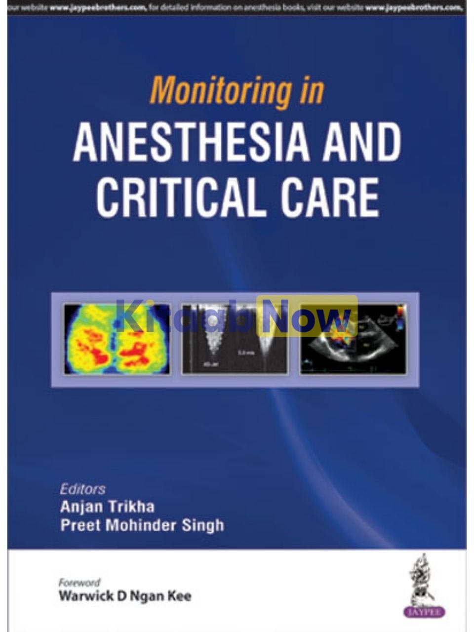 Monitoring In Anesthesia And Critical Care