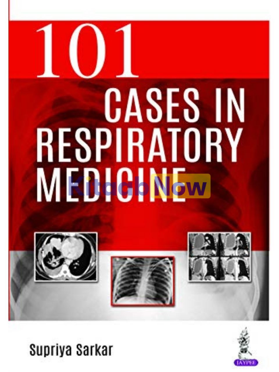 101 Cases in Respiratory Medicine | KitaabNow